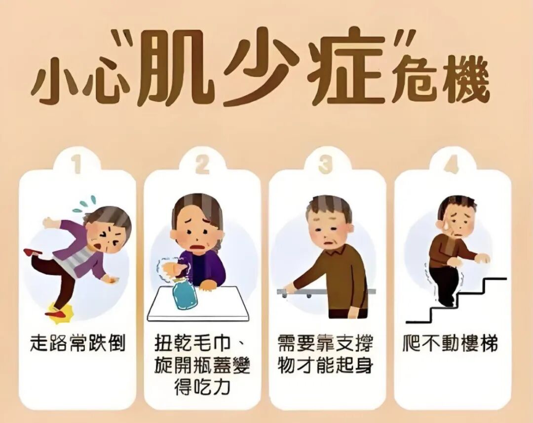 肌少癥如何有效識別并改善？